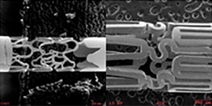 Cardiovascular Stent Processing