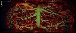 Ultrasound Imaging